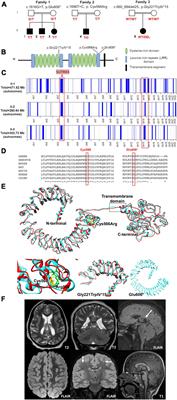 Human mutations in SLITRK3 implicated in GABAergic synapse development in mice